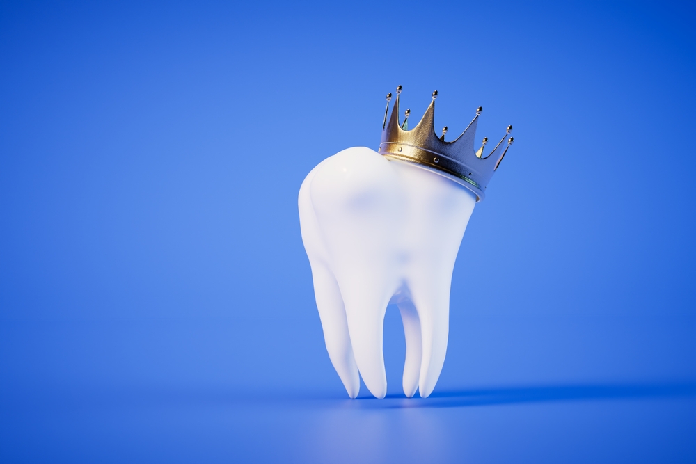 dental implants vs dental crowns