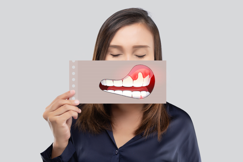 gum disease treatment in san antonio tx