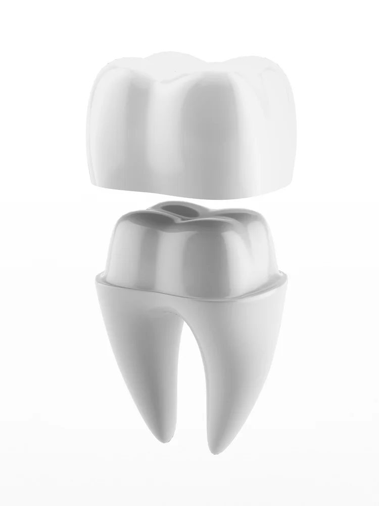 Types of Dental Crowns: How to Choose the Right Fit for Your Lifestyle