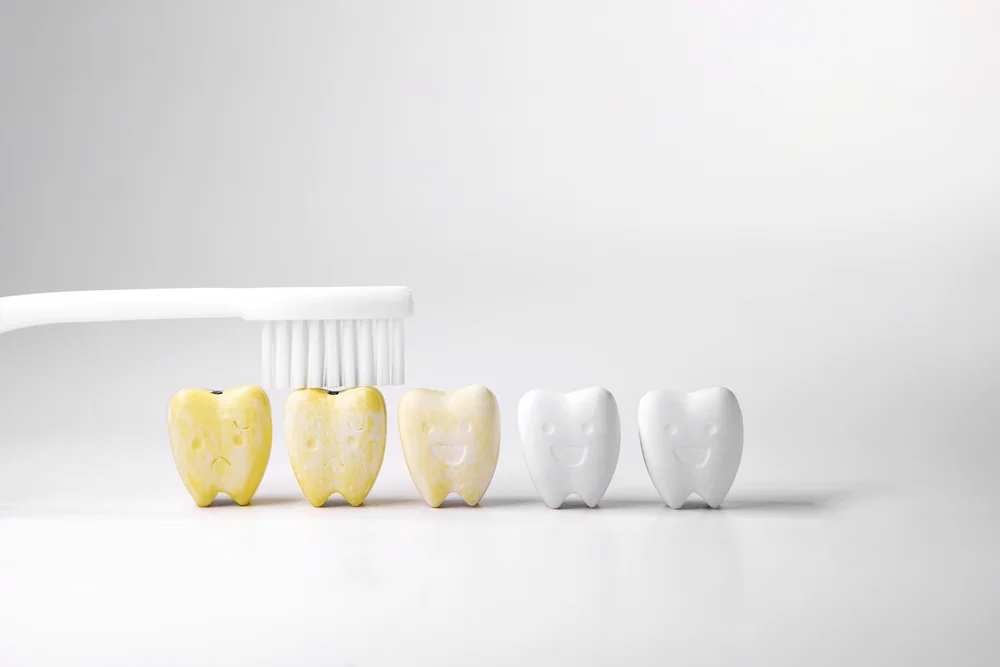 In-Office Teeth Whitening in San Antonio