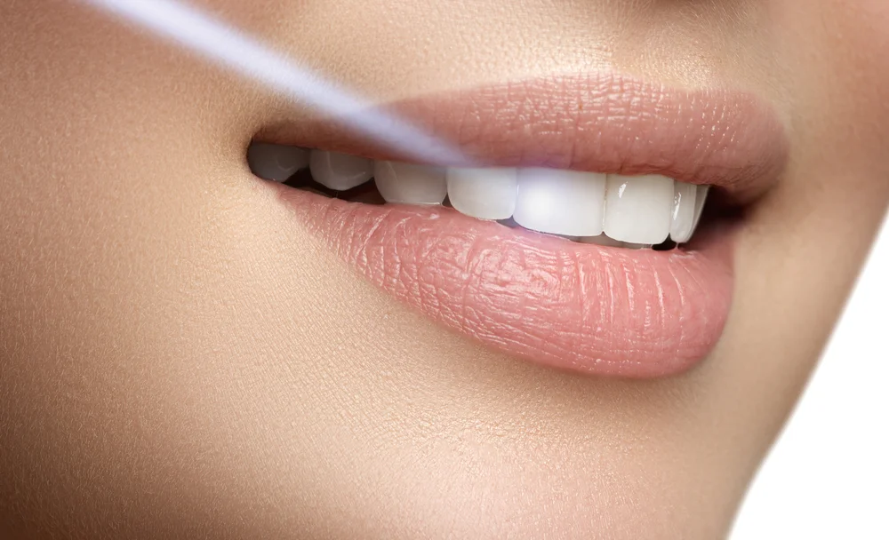 Teeth Whitening: The Art of Teeth Brightening