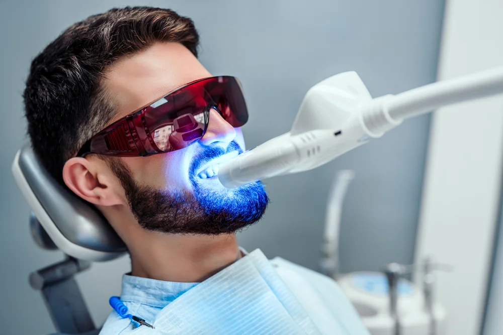 Teeth Whitening: The Art of Teeth Brightening