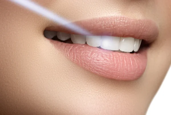 Activated Charcoal: The Trendy Natural Whitening Agent