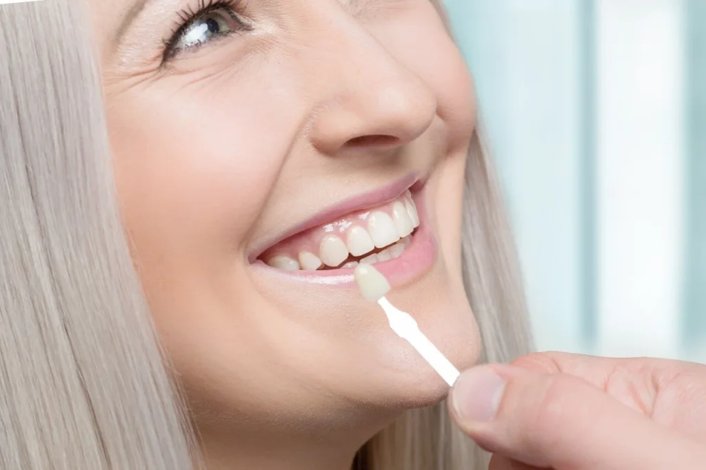 Aftercare for Veneer Teeth Near Me: Tips to Keep Your Smile Bright